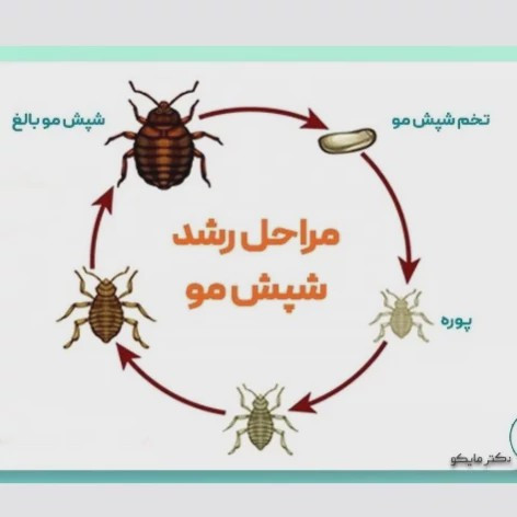 سم شپش کش مو و محیط پرمکترین مبارز قوی شپش ارسال رایگان