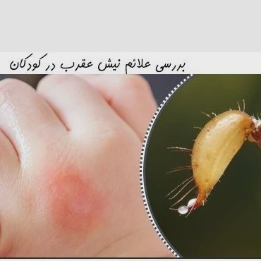 سم عقرب کش پایروساید یک لیتری بدون بو ارسال رایگان