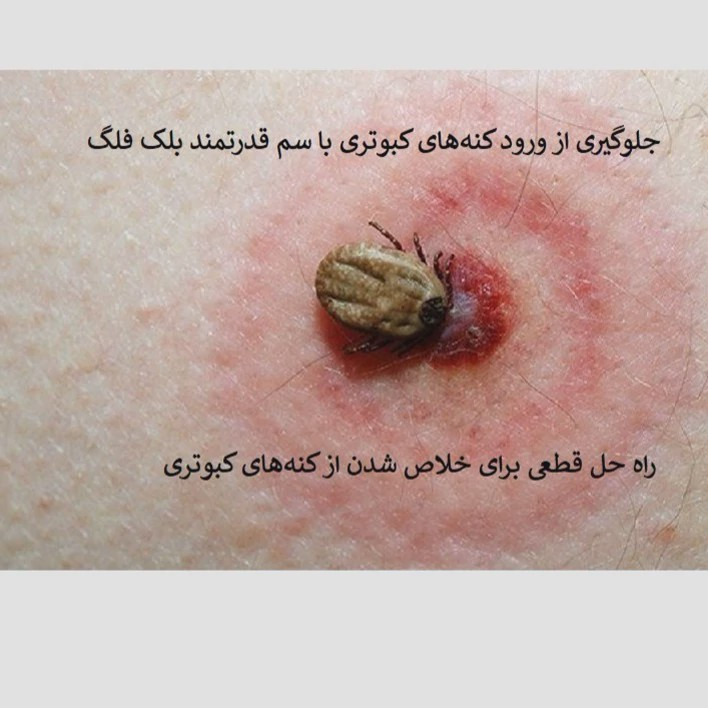 نابودی فوری کنه کبوتری با سم بلک فلگ