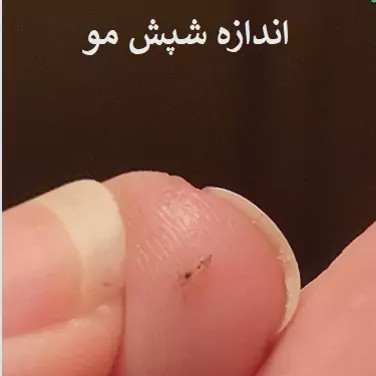 سم شپش کش پرمکترین ارسال رایگان مدل 1